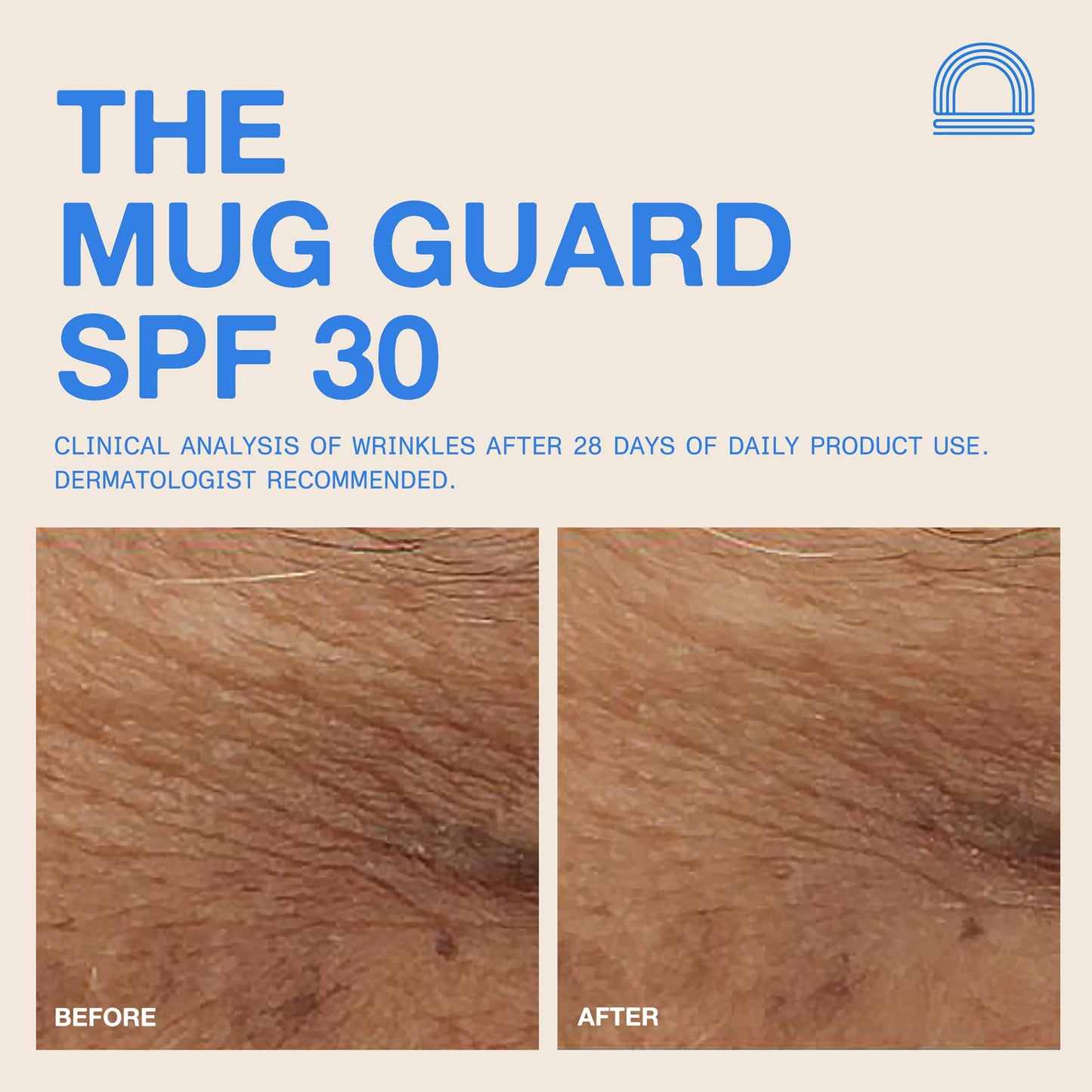 DUNE Suncare - The Mug Guard