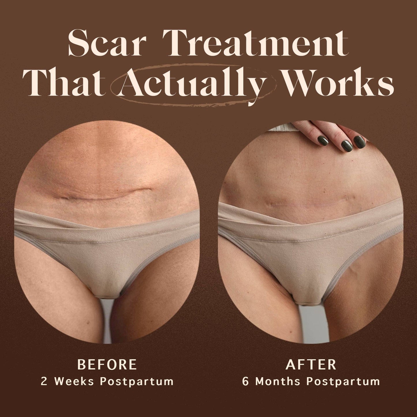 Nēmah - Renewing Scar Cream